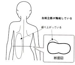 肩の高さが違ったりして左右非対称になっている身体を骨から整え神経血管の圧迫が解消