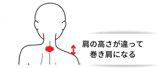 肩の高さが違う